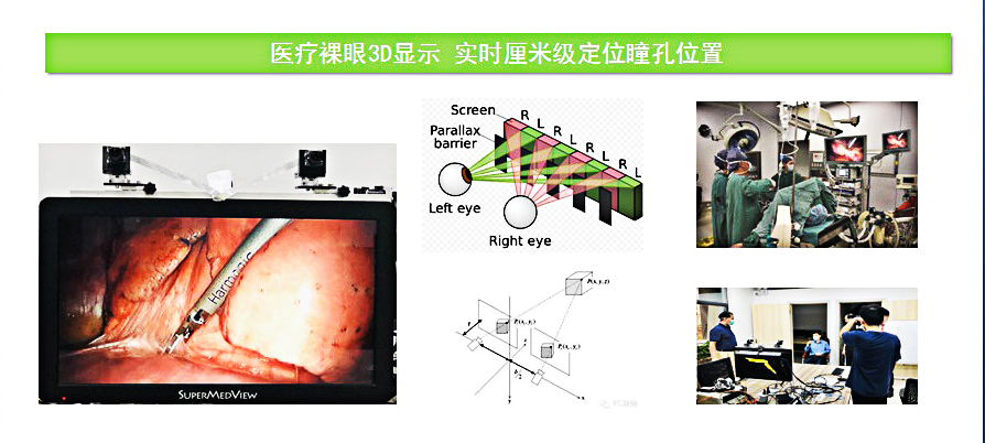 医疗裸眼3D显示 实时厘米级定位瞳孔位置